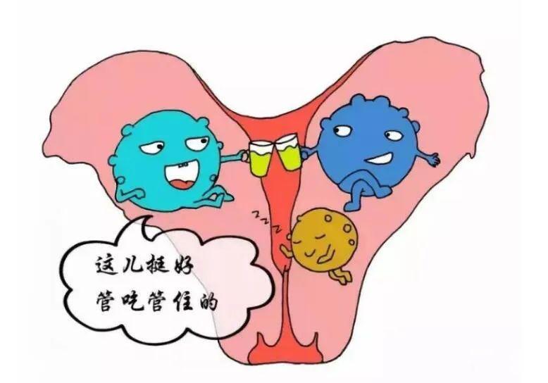 子宫腺肌症最新治疗方法详解与步骤指南