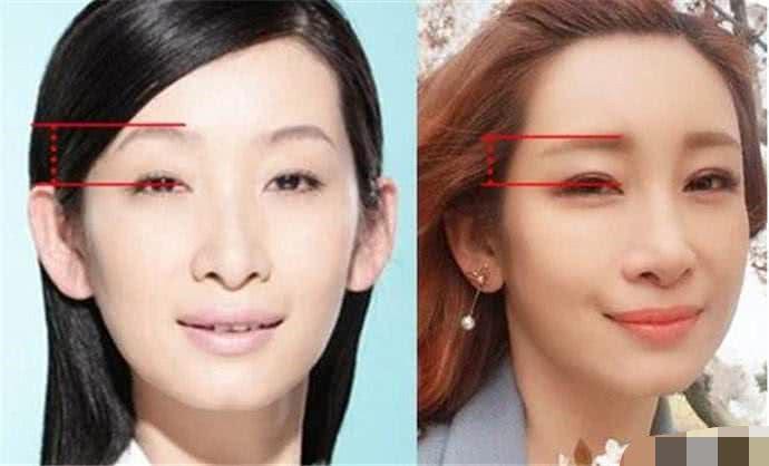 女明星双眼皮的秘密大揭秘，双眼皮背后的故事 🔍👀
